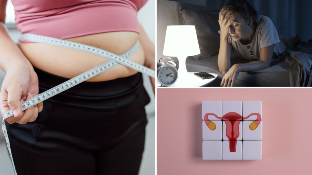 Obesity, Insomnia and PCOS lifestyle disorders
